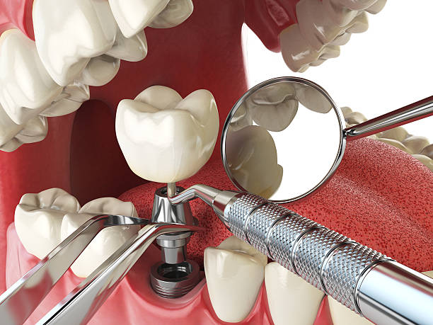 Best Walk-In Emergency Dentist in Brooksi, DE